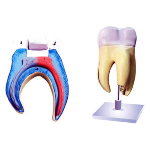 Maxillary Molar Tooth with Advanced Dental Caries manufacturerindiaprice_infralabindia
